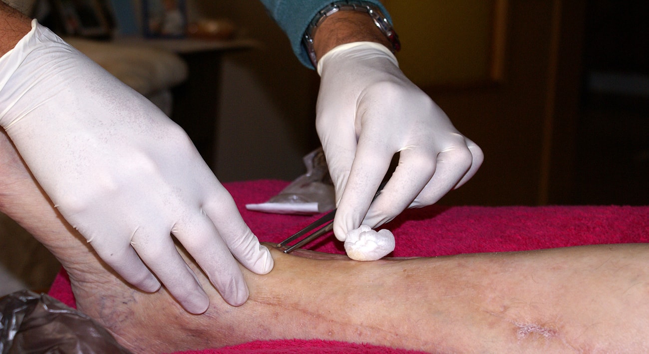 medicazione di un piede