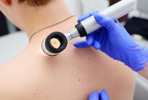 Nuovo servizio di dermatologia