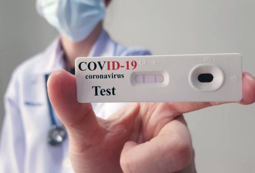 Esecuzione test Covid a persone
